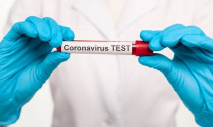 ПЛР-тестування на коронавірус COVID-19 (з забором мазків з носоглотки та ротоглотки)